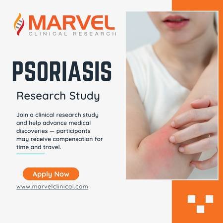 Earn Money for Paid Participation in a Psoriasis Clinical Study in Huntington Beach
