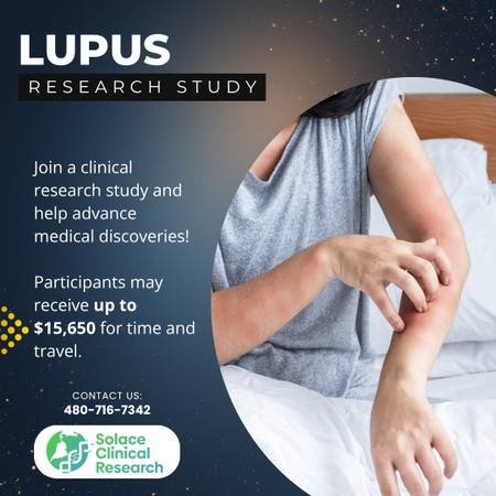 Earn up to $15,650 by Joining a Study for Lupus in Tustin