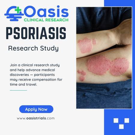Join Our Plaque Psoriasis Study at Oasis Clinical Research in Las Vegas